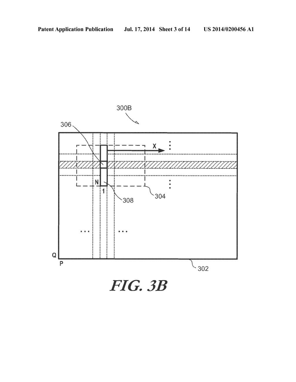 SEPARABLE BEAMFORMING FOR ULTRASOUND ARRAY - diagram, schematic, and image 04