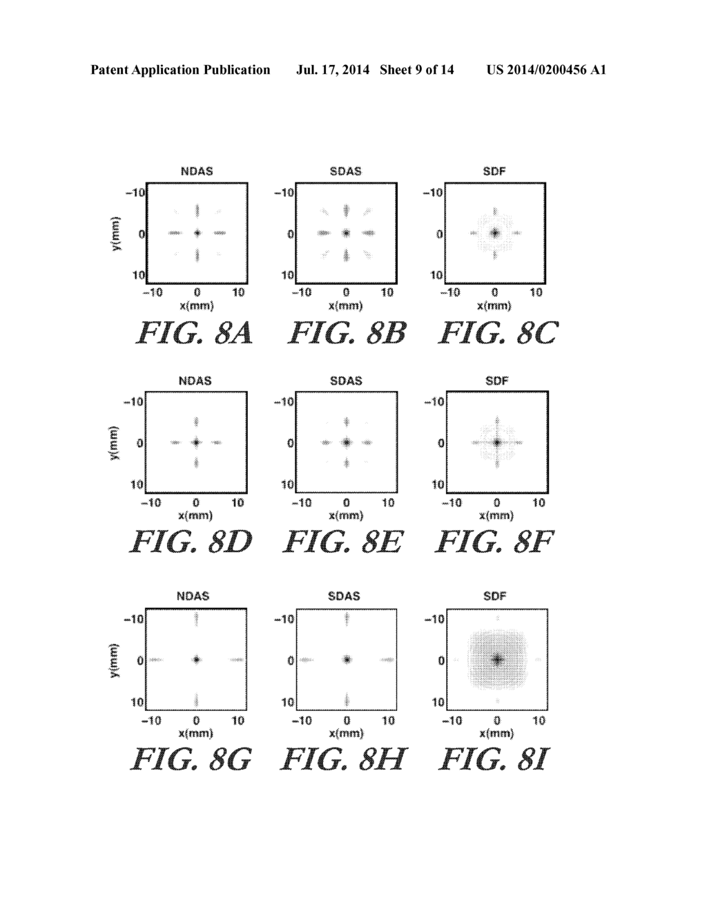 SEPARABLE BEAMFORMING FOR ULTRASOUND ARRAY - diagram, schematic, and image 10