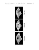 METHODS AND SYSTEMS FOR DETERMINING SPATIOTEMPORAL VARIABILITY FOR MAPPING     CARDIAC FIBRILLATION diagram and image