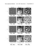 METHODS AND SYSTEMS FOR DETERMINING SPATIOTEMPORAL VARIABILITY FOR MAPPING     CARDIAC FIBRILLATION diagram and image