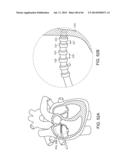 METHODS AND SYSTEMS FOR DETERMINING SPATIOTEMPORAL VARIABILITY FOR MAPPING     CARDIAC FIBRILLATION diagram and image