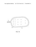 METHODS AND SYSTEMS FOR DETERMINING SPATIOTEMPORAL VARIABILITY FOR MAPPING     CARDIAC FIBRILLATION diagram and image