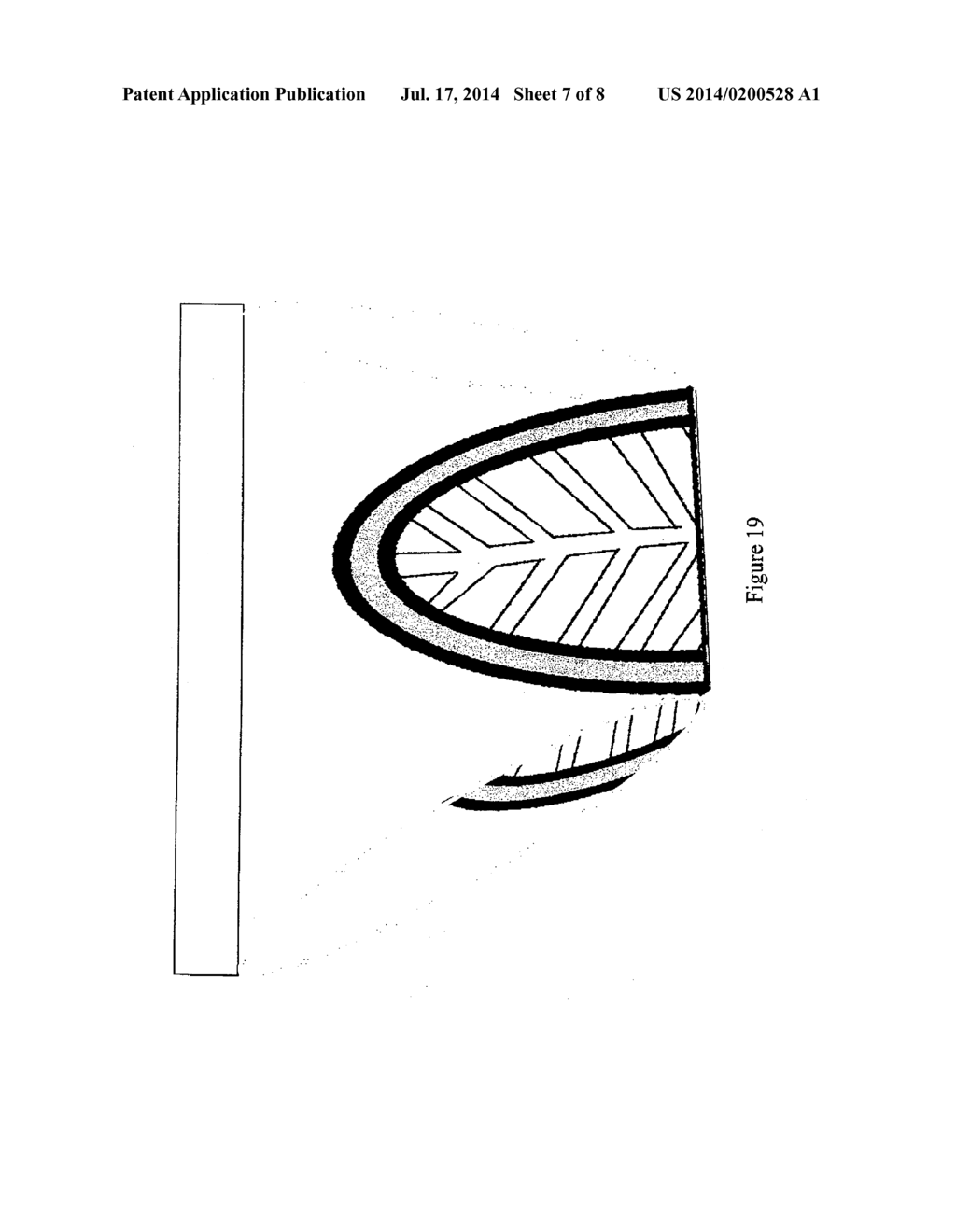 Ultimate Bikini Under pads (UBUP) - diagram, schematic, and image 08