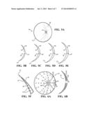 POST-NIPPLE RECONSTRUCTION PROTECTOR diagram and image