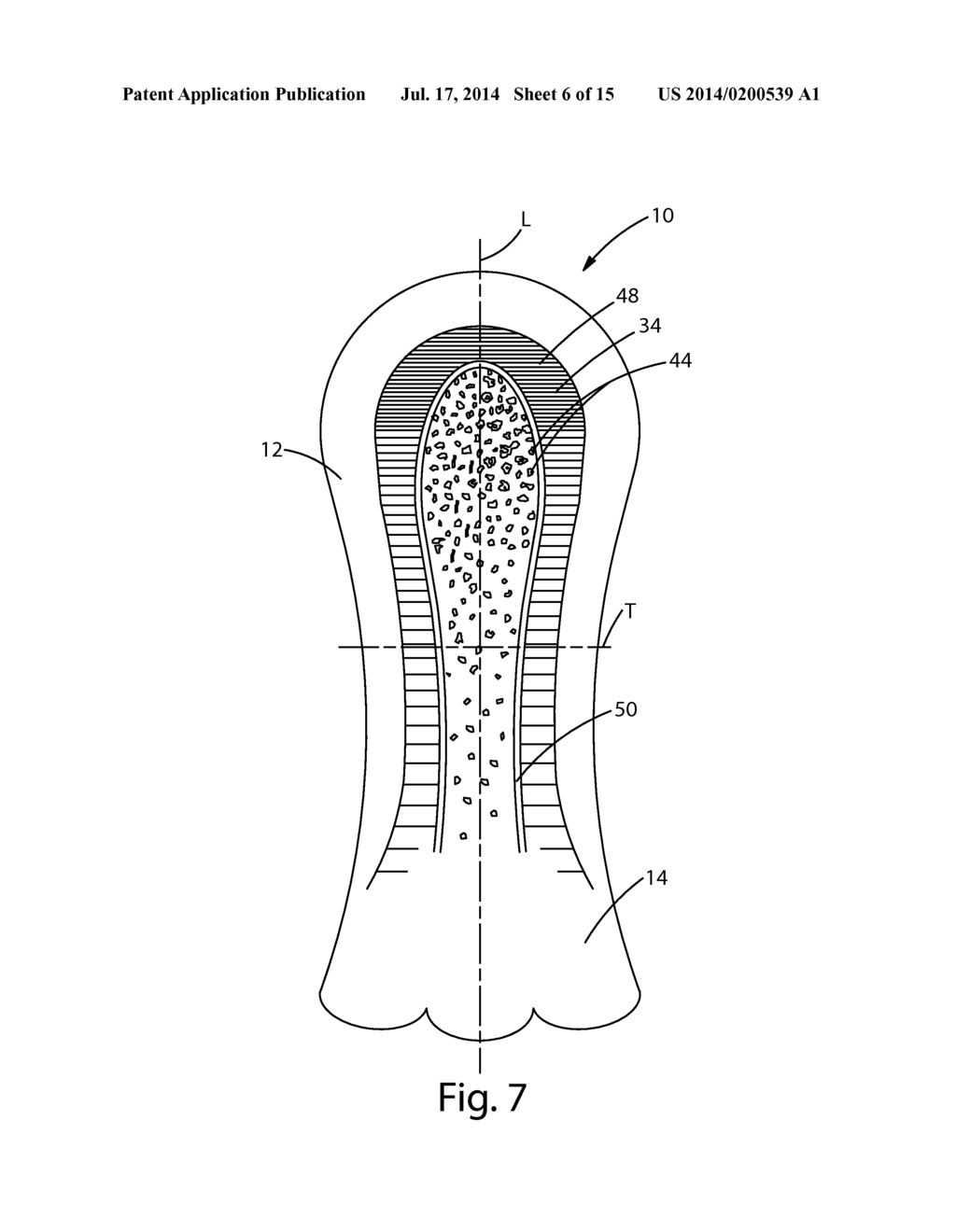 ARRAY OF ABSORBENT ARTICLES HAVING FUNCTIONAL ENHANCEMENT INDICATORS - diagram, schematic, and image 07