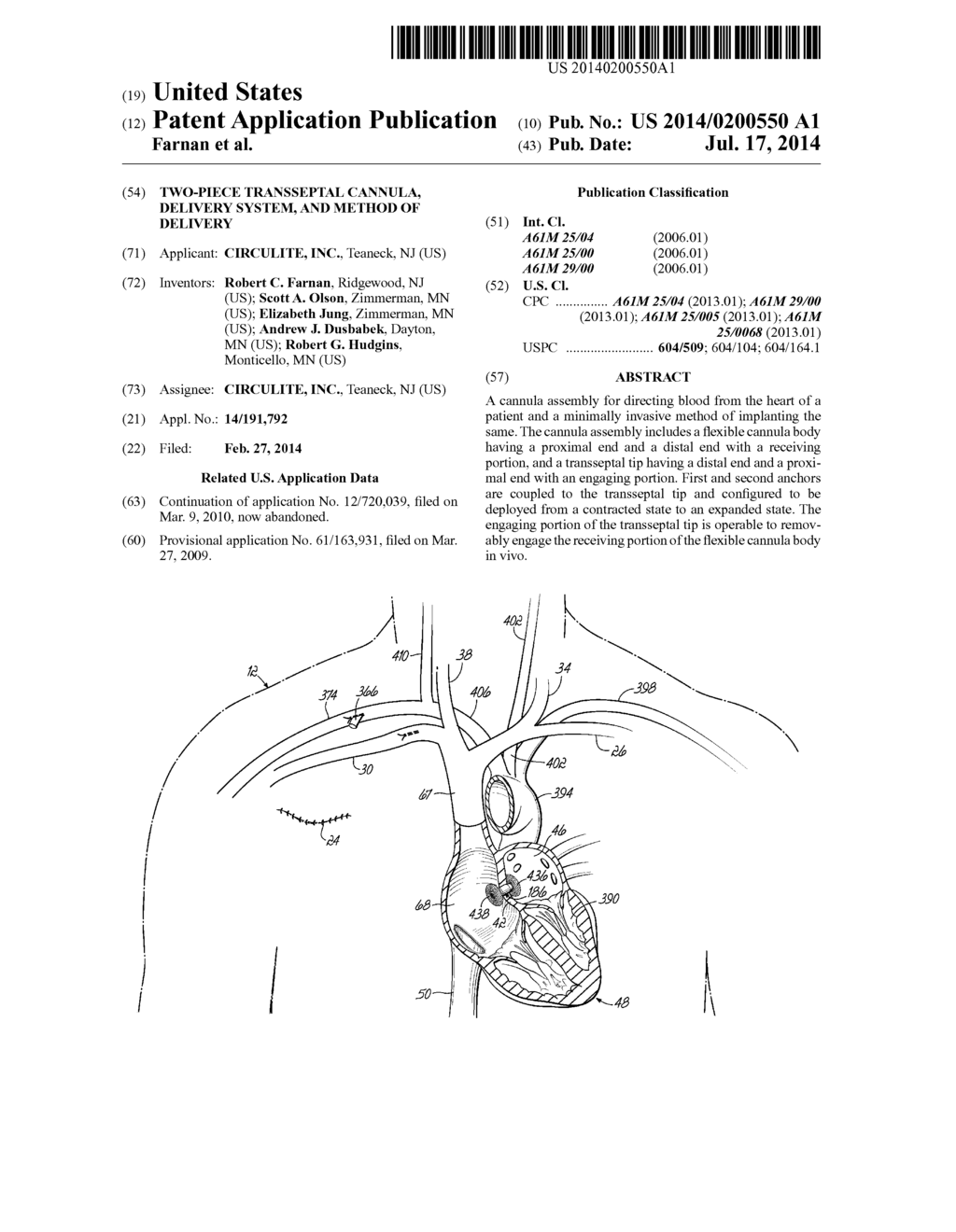 TWO-PIECE TRANSSEPTAL CANNULA, DELIVERY SYSTEM, AND METHOD OF DELIVERY - diagram, schematic, and image 01