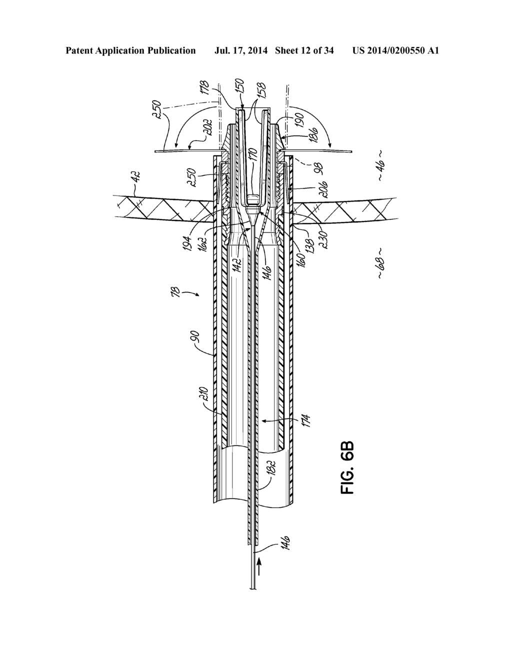 TWO-PIECE TRANSSEPTAL CANNULA, DELIVERY SYSTEM, AND METHOD OF DELIVERY - diagram, schematic, and image 13