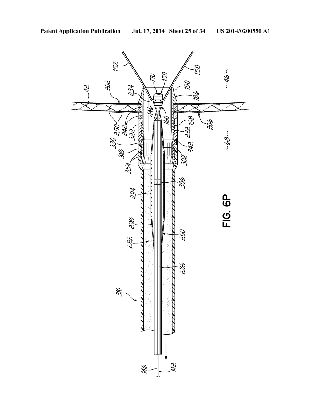 TWO-PIECE TRANSSEPTAL CANNULA, DELIVERY SYSTEM, AND METHOD OF DELIVERY - diagram, schematic, and image 26