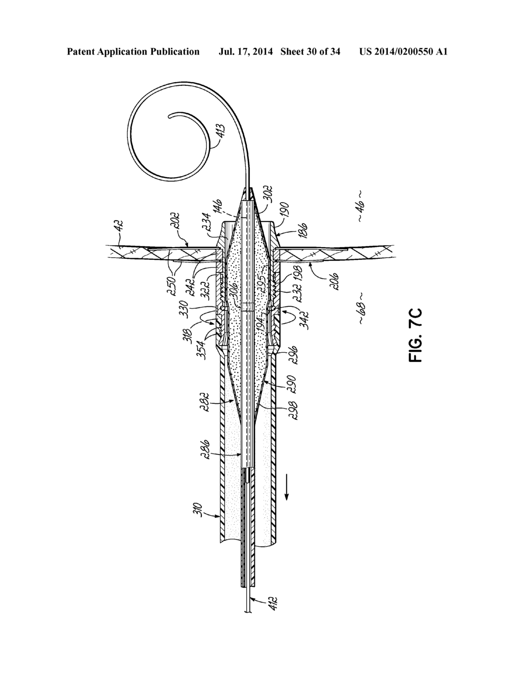 TWO-PIECE TRANSSEPTAL CANNULA, DELIVERY SYSTEM, AND METHOD OF DELIVERY - diagram, schematic, and image 31