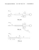 Method and Apparatus for Tissue Ablation diagram and image