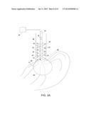 Method and Apparatus for Tissue Ablation diagram and image