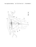 Method and Apparatus for Tissue Ablation diagram and image