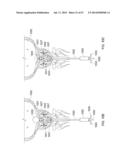 Method and Apparatus for Tissue Ablation diagram and image