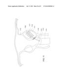 Method and Apparatus for Tissue Ablation diagram and image