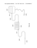 Method and Apparatus for Tissue Ablation diagram and image