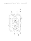 Method and Apparatus for Tissue Ablation diagram and image