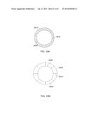 Method and Apparatus for Tissue Ablation diagram and image