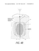 MEDICAL SYSTEM AND METHOD OF USE diagram and image