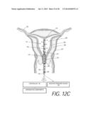 MEDICAL SYSTEM AND METHOD OF USE diagram and image