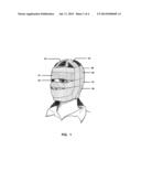 Method and apparatus of face lifting that move facial tissues up and hold diagram and image