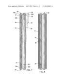 Anti-Displacement Coil Spring-Type Spine Stabilization Device diagram and image