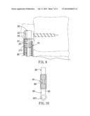 Anti-Displacement Coil Spring-Type Spine Stabilization Device diagram and image