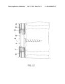 Anti-Displacement Coil Spring-Type Spine Stabilization Device diagram and image