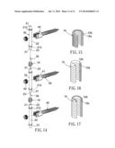 Anti-Displacement Coil Spring-Type Spine Stabilization Device diagram and image