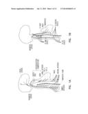 INTERMITTENT NEURAL STIMULATION WITH PHYSIOLOGIC RESPONSE MONITOR diagram and image