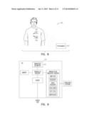 INTERMITTENT NEURAL STIMULATION WITH PHYSIOLOGIC RESPONSE MONITOR diagram and image