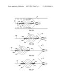 METHODS AND APPARATUS FOR LUMINAL STENTING diagram and image