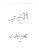 METHODS AND APPARATUS FOR LUMINAL STENTING diagram and image