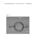 ANCHORING ELEMENTS FOR INTRACARDIAC DEVICES diagram and image