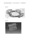 ANCHORING ELEMENTS FOR INTRACARDIAC DEVICES diagram and image