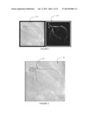 VASCULAR FLOW ASSESSMENT diagram and image