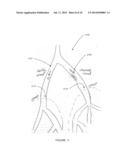 VASCULAR FLOW ASSESSMENT diagram and image