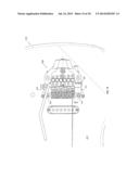 TOP MOUNTED TREMOLO AND TUNING APPARATUS diagram and image