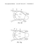 PATIENT INTERFACE DEVICE diagram and image