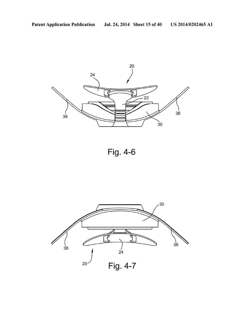 FLEXIBLE FOREHEAD SUPPORT - diagram, schematic, and image 16