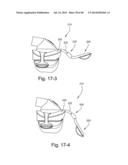 FLEXIBLE FOREHEAD SUPPORT diagram and image