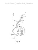 FLEXIBLE FOREHEAD SUPPORT diagram and image