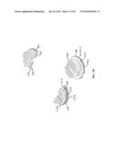 APPARATUS WITH ELLIPTICAL MOVEMENT FOR MICRODERMABRASION AND TOPICAL     DELIVERY OF TREATMENTS diagram and image