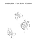 APPARATUS WITH ELLIPTICAL MOVEMENT FOR MICRODERMABRASION AND TOPICAL     DELIVERY OF TREATMENTS diagram and image