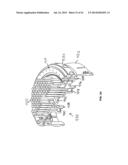 APPARATUS WITH ELLIPTICAL MOVEMENT FOR MICRODERMABRASION AND TOPICAL     DELIVERY OF TREATMENTS diagram and image