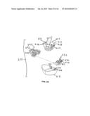 APPARATUS WITH ELLIPTICAL MOVEMENT FOR MICRODERMABRASION AND TOPICAL     DELIVERY OF TREATMENTS diagram and image