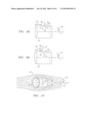 APPARATUS FOR MAGNETIC AND ELECTROSTATIC CONFINEMENT OF PLASMA diagram and image