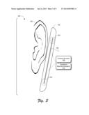 Utilization of Antenna Loading for Impedance Matching diagram and image