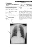 METHOD FOR IMPROVED DETECTION OF NODULES IN MEDICAL IMAGES diagram and image