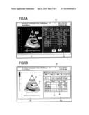 MEDICAL IMAGE DIAGNOSIS APPARATUS, MEDICAL IMAGE PROCESSING APPARATUS, AND     MEDICAL IMAGE PROCESSING METHOD diagram and image