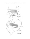 FURNITURE JOINT diagram and image